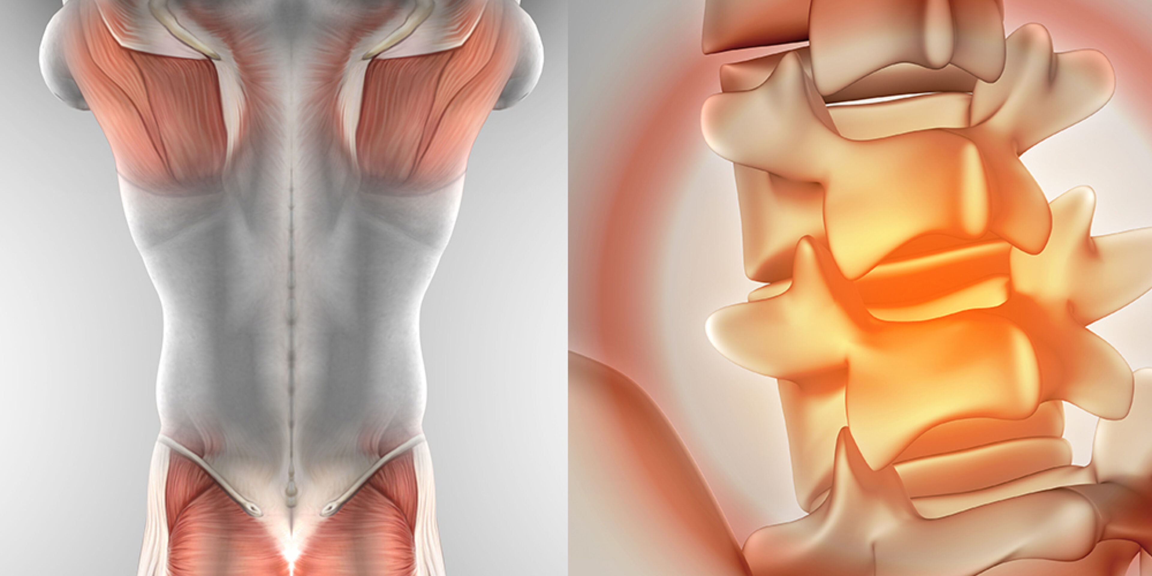Prevent Work-related Musculoskeletal Disorders (MSDs) With Ergonomic ...