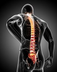 Overexertion Back Pain